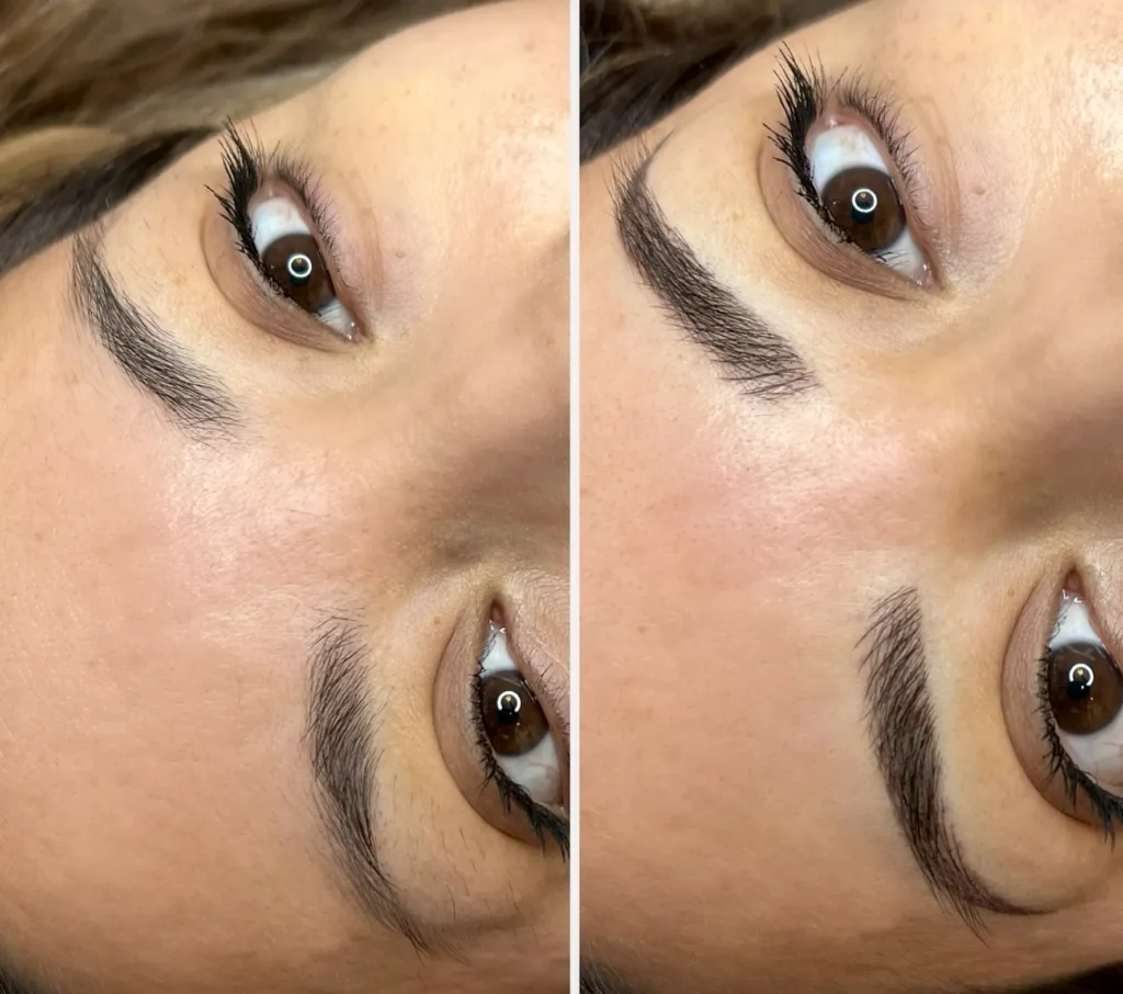 Brisbane Skin and Lifestyle Considerations