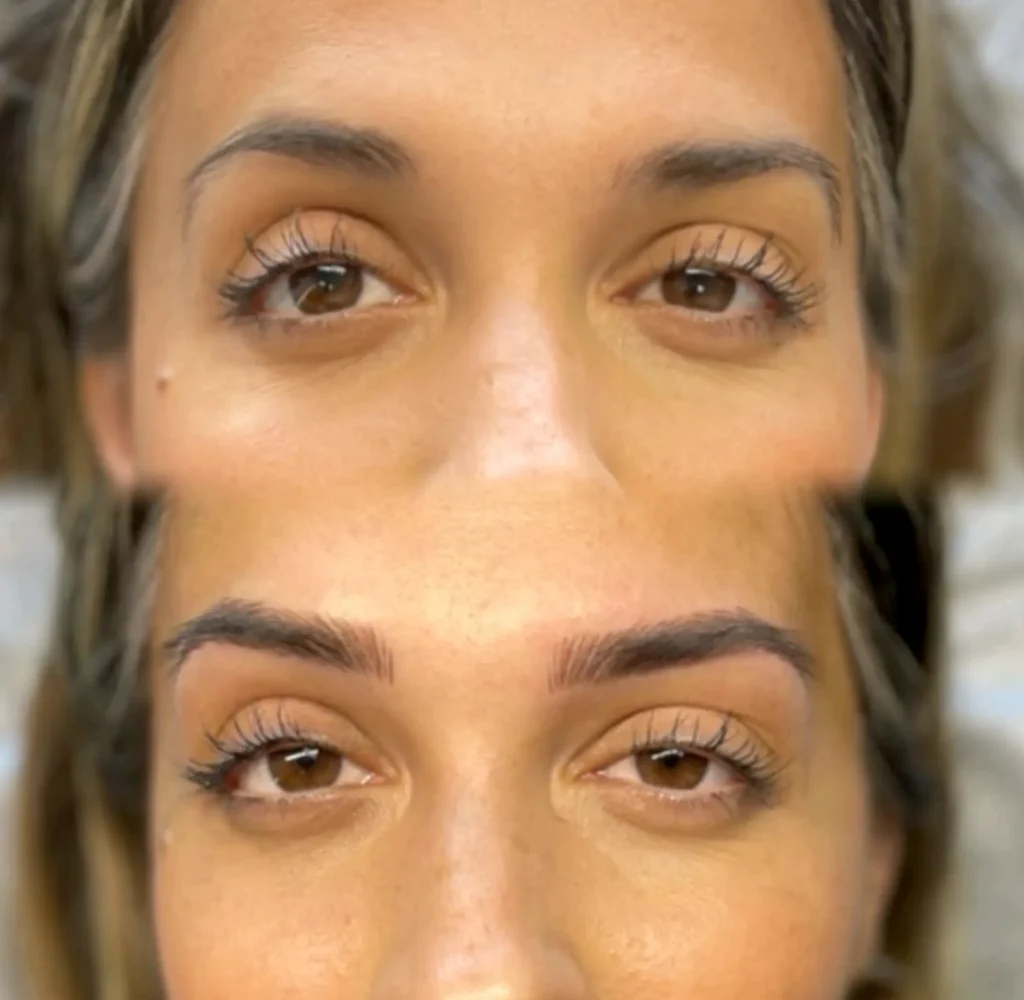 Brow Tattooing